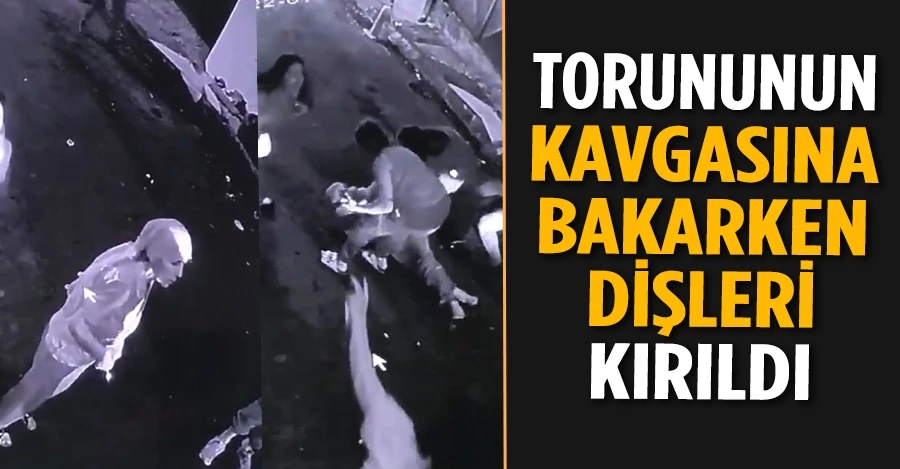 İstanbul’da feci olay kamerada: Torununun kavgasına bakarken dişleri kırıldı 
